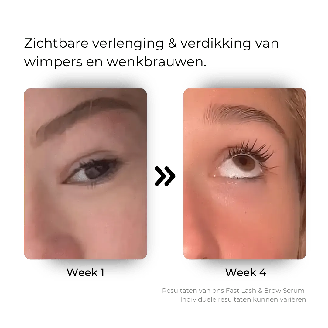 Flore Lumière® Wimper & Wenkbrauwserum - Flore Lumière